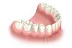 Dental Implants by Dr. David Richardson - Charleston South Carolina Implant Dentist